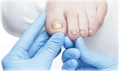 Podolek Monika Skinderowicz Gabinet podologiczny Wrocław Podolog Pedicure kosmetyczny Pedicure leczniczy